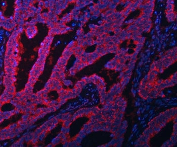 EIF3A Antibody / Eukaryotic translation initiation factor 3 subunit A