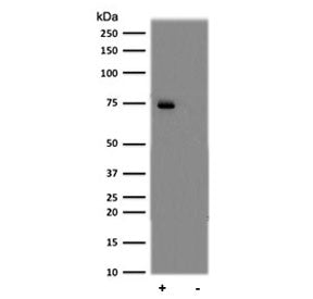 Western blot testing of treated (Calyculin A + TNF-alpha) and untreated human Daudi cell lysate with