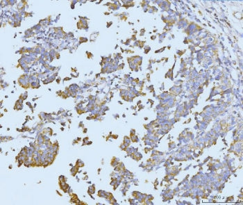 ETFA Antibody