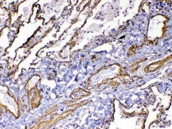 VEGF Receptor 3 Antibody / VEGFR3