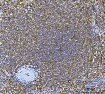 IHC staining of FFPE human spleen tissue with Interferon regulatory factor 7 antibody. HIER: boil ti