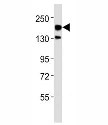 Western blot testing of ERBB4 antibody at 1:500 dilution + rat brain lysate; Predicted molecular wei