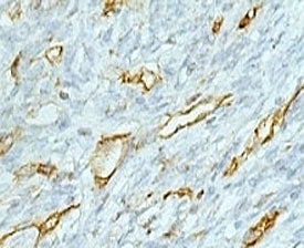 CD31 Antibody / PECAM-1