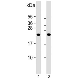 Western blot testing of human 1) uterus and 2) CCRF-CEM lysate with KLRC2 antibody. Predicted molecu
