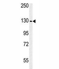 IGF1 Receptor Antibody (IGF1R)