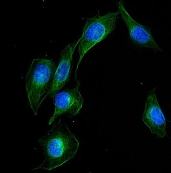 UBE2Q2 Antibody