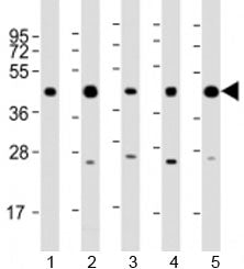 PHF6 Antibody / PHD finger protein 6