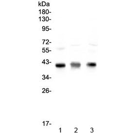 CCR4 Antibody