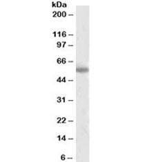 Tyrosine Hydroxylase Antibody