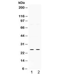 Western blot testing of human 1) HeLa and 2) SMMC cell lysate with Thymidine kinase 1 antibody. Expe