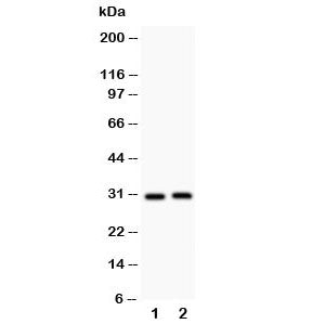 Western blot testing of IL-1b antibody and Lane 1: rat spleen; 2: rat thymus; Predicted molecular we