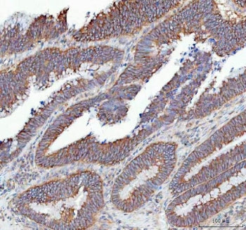 SLC12A6 Antibody