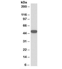 Keratin 18 Antibody