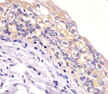 Bid Antibody / BH3-Interacting Domain Death Agonist