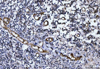 von Willebrand Factor Antibody / vWF