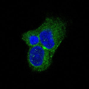 TH Antibody / Tyrosine Hydroxylase