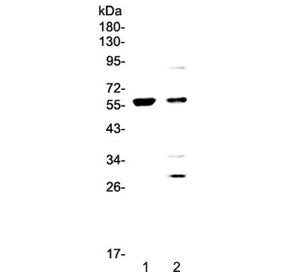PDK1 Antibody / Pyruvate Dehydrogenase Kinase 1