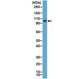 SATB2 Antibody