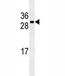 CDCA8 Antibody, 0.4ml