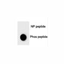BAD Antibody (phospho-S124)
