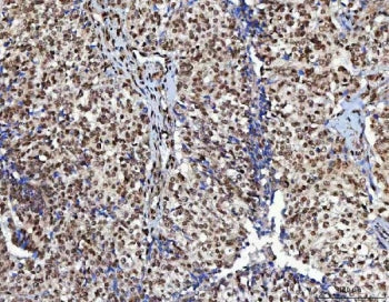NUDCD1 Antibody / CML66