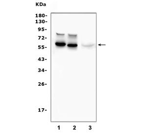 Tyrosine Hydroxylase Antibody