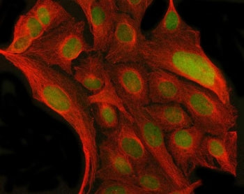 MYNN Antibody / Myoneurin