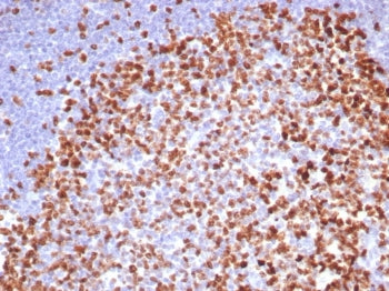 Ki-67 Antibody
