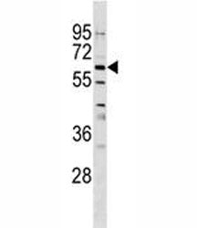 GPNMB Antibody