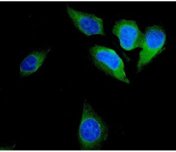FHIT Antibody