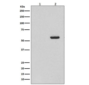 Phospho-Tau Antibody / MAPT (pS396)
