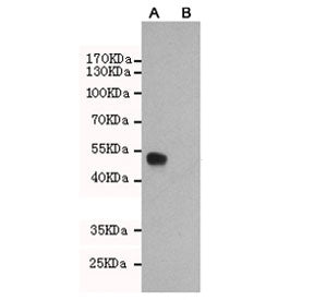 Estrogen Receptor alpha Antibody