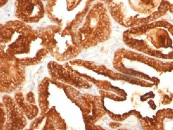 PSAP Antibody / Prostate Specific Acid Phosphatase