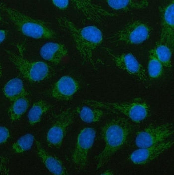LCMT2 Antibody / tRNA wybutosine-synthesizing protein 4