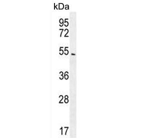 Beta Arrestin 1 Antibody / ARRB1