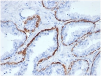 IHC staining of FFPE human prostate tissue with CK5 antibody (clone KRT5/6466). HIER: boil tissue se