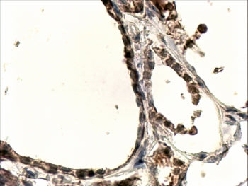 DUOX1 Antibody