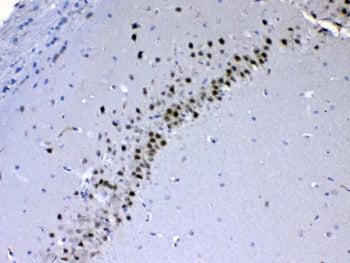 IHC testing of FFPE rat brain tissue with CHD2 antibody at 1ug/ml. Required HIER: steam section in p