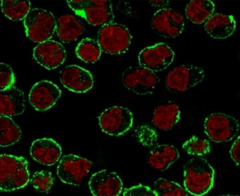 CD19 Antibody / B-lymphocyte marker