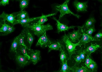 Immunofluorescent staining of FFPE human A549 cells with FBL antibody (Dylight 594-conjugated second