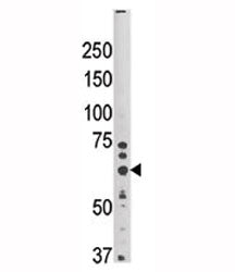 Western blot analysis of HRD1 antibody and mouse brain tissue lysate. Predicted molecular weight: ~6
