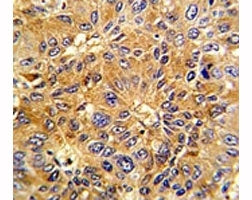 Cyclin A2 Antibody (CCNA2)
