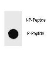 PARP Antibody (phospho-S372)