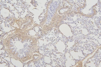 Fam70b Antibody / Tmem255b