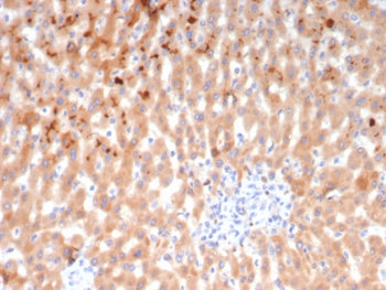 Bradykinin Antibody / Kininogen