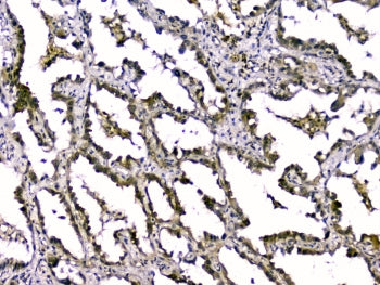 TGFB2 Antibody / TGF beta 2