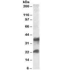 Western blot testing of human frontal cortex lysate with Clatherin Light Chain antibody at 0.1ug/ml.