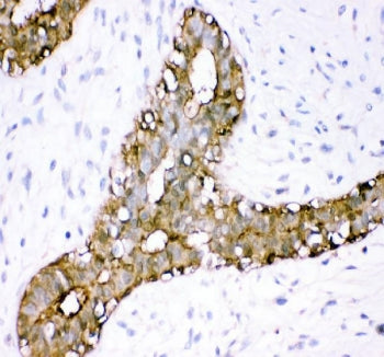 Annexin A3 Antibody