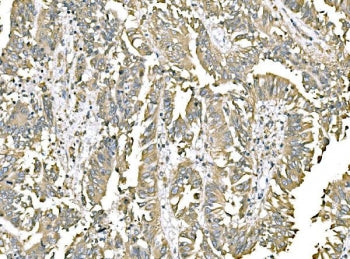 PDIA3 Antibody / ERp57