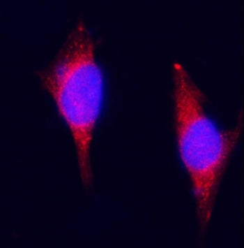 Plagl1 Antibody / Pleiomorphic adenoma-like protein 1
